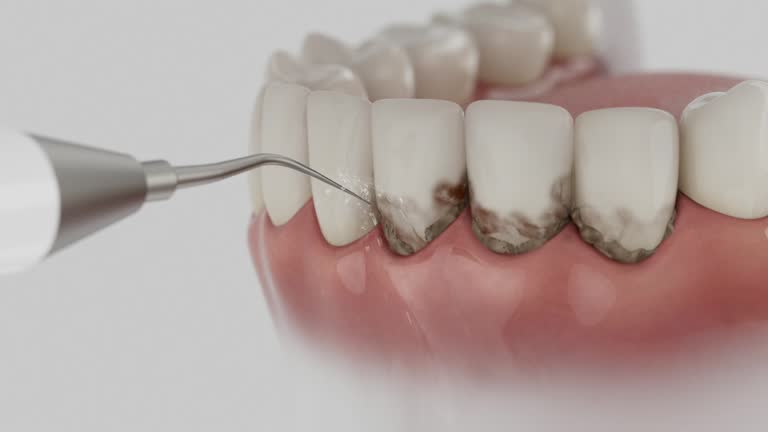 Reliable Wisdom Tooth Removal contractor in Marin County County, CA by Dentist Open Now